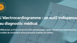 L’électrocardiogramme : outil indispensable au diagnostic médical