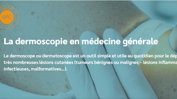 La dermoscopie en médecine générale