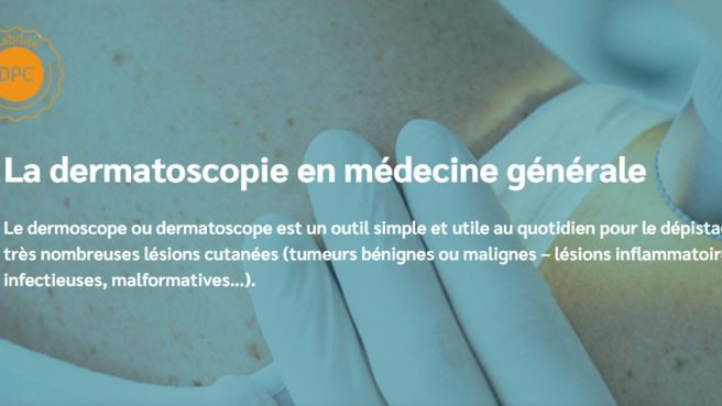 La dermatoscopie en médecine générale